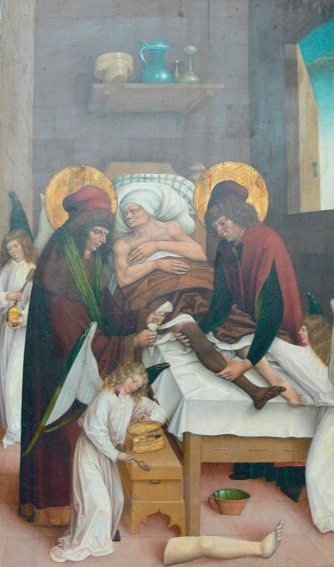 Figure 41.1, St. Cosmas and St. Damian perform the first human extremity allotransplantation. Per mythology, Christian Roman deacon Justinian had a malignant growth on his leg and fell asleep while praying for a cure in the Church of Cosmas and Damian in Rome. In his dreams, the saints amputated the diseased limb and transplanted the leg of a Moor, brought to the church for burial. The patient awoke and gratefully observed a now healthy leg, though black in color.