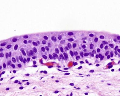 Figure 15-2, Histology of normal urothelium (H&E, ×MP).