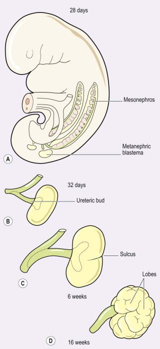 FIGURE 18-2, Formation of the definitive kidney. (A) The metanephric blastema develops on each side of the body early in the 5th week. (B) The ureteric bud grows out to the metanephric blastema. (C) The ureteric bud bifurcates to produce superior and inferior lobes in the metanephros. (D) Additional lobules form during the next 10 weeks in response to further bifurcation of the ureteric buds.