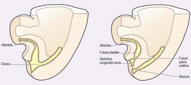 FIGURE 18-3, Formation of the bladder and rectum. The bladder and rectum form from the cloaca. The urorectal septum separates the bladder from the rectum. The urogenital sinus becomes the penile urethra in the male and the vestibule of the vagina in the female.