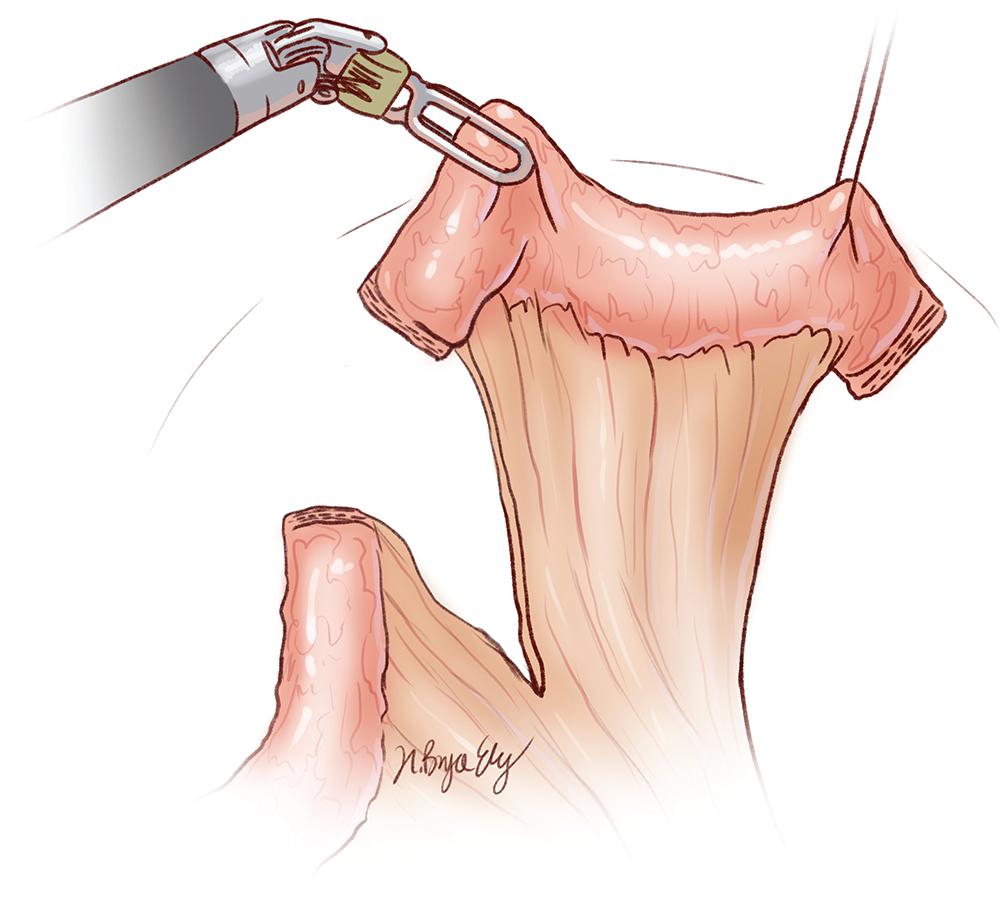 Fig. 26.3, Isolation of the Conduit.