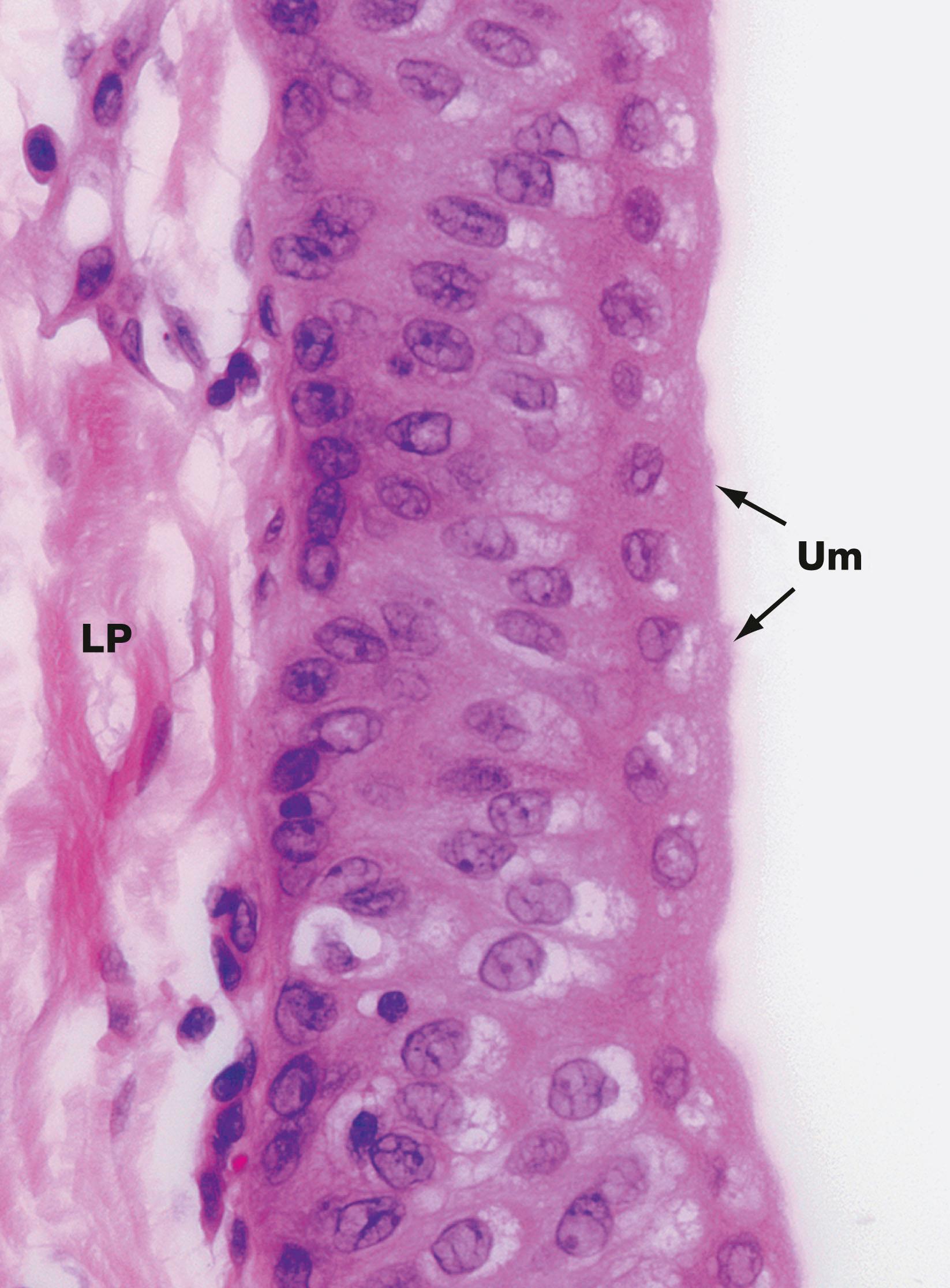 Fig. 16.25, Transitional epithelium