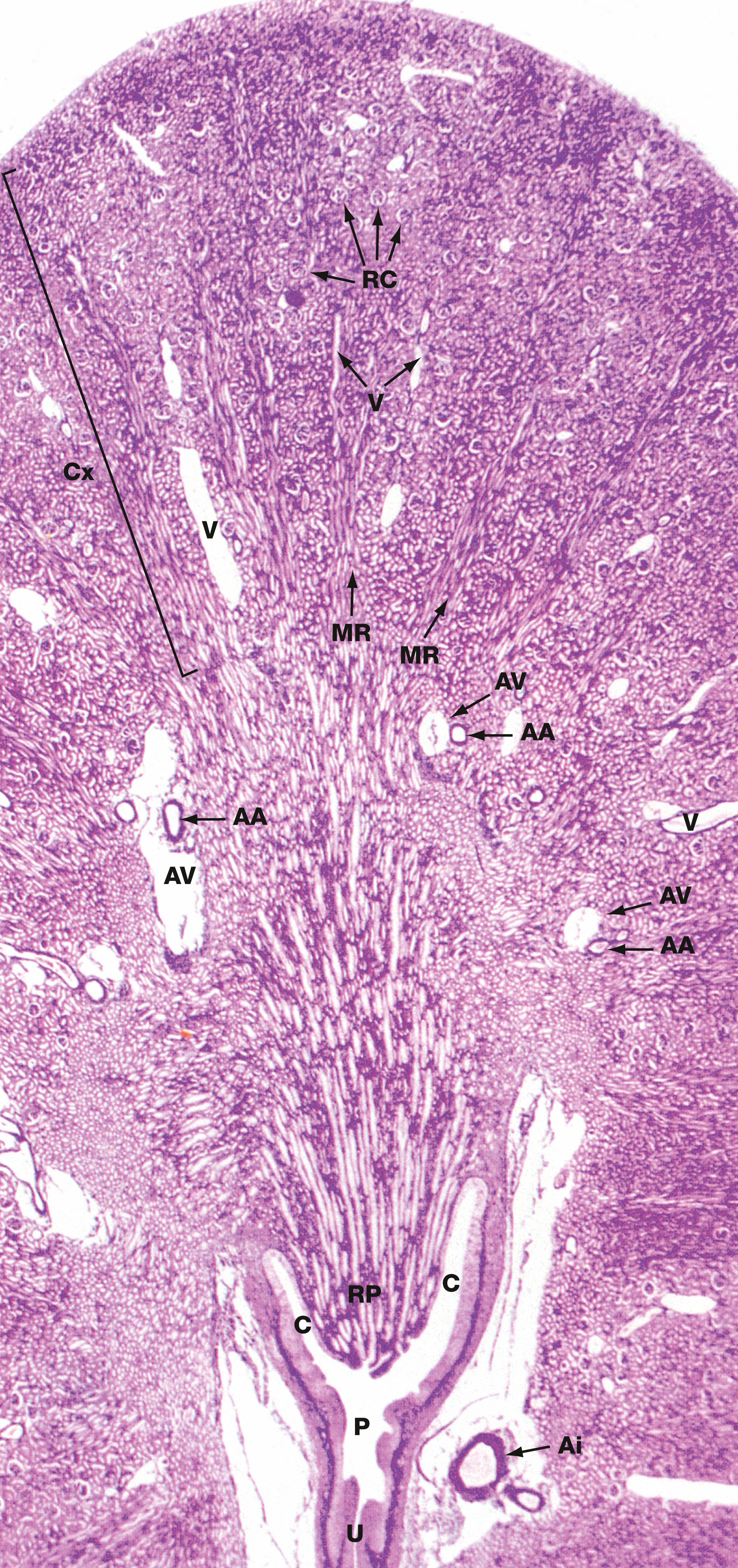 Fig. 16.5, Kidney, monkey Jones methenamine silver