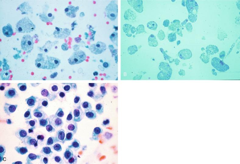 Fig. 7.4, (A) Proximal and distal convoluted cells from the nephron. (B) Necrotic proximal and distal convoluted cells. (C) Collecting duct cells.