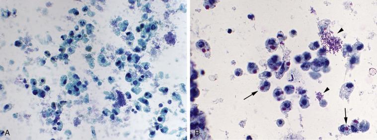 Fig. 3.7, Ileal Loop Specimen.