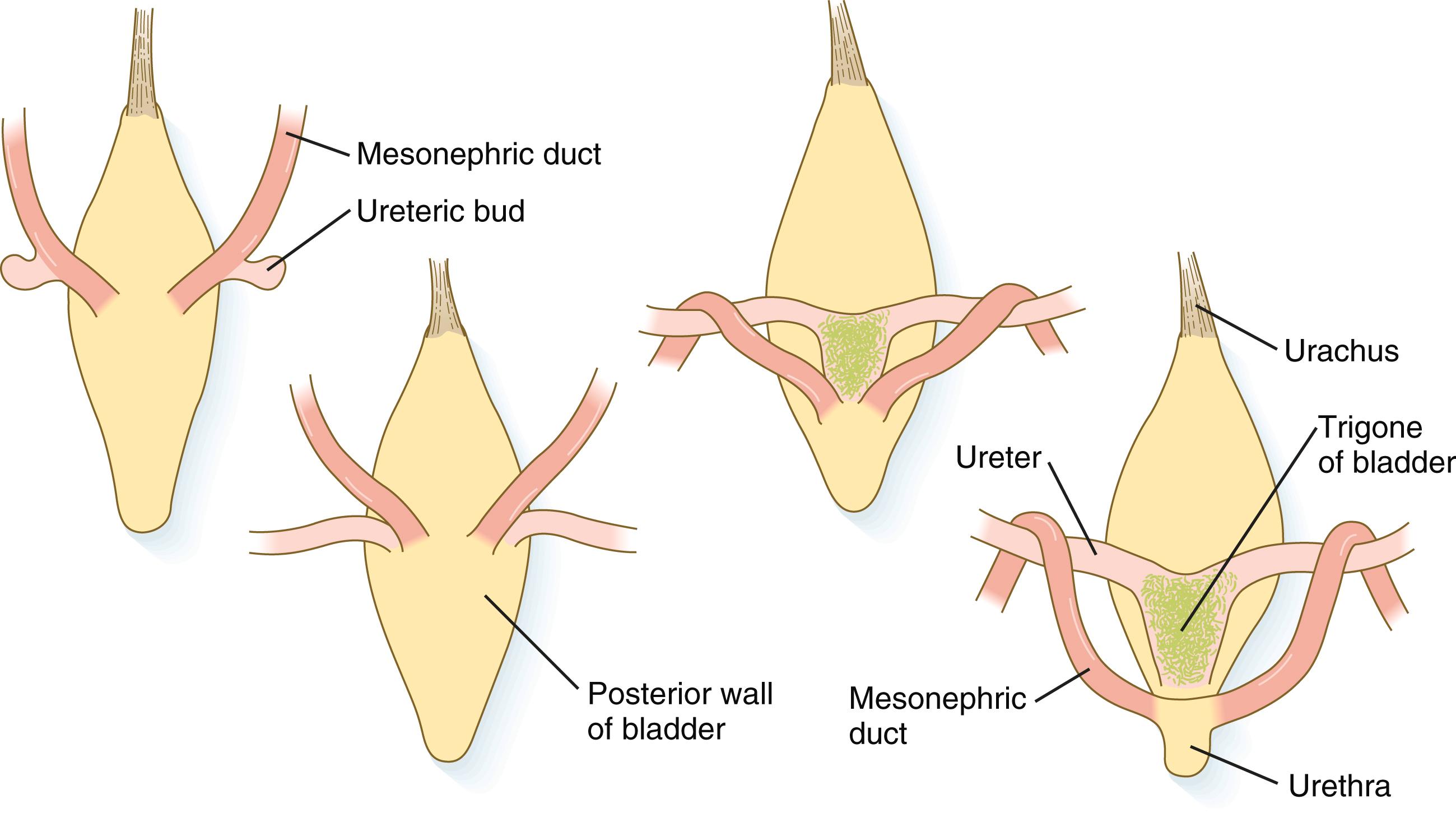 Fig. 16.12, Dorsal views of the developing urinary bladder showing changing relationships of the mesonephric ducts and the ureters as they approach and become incorporated into the bladder.