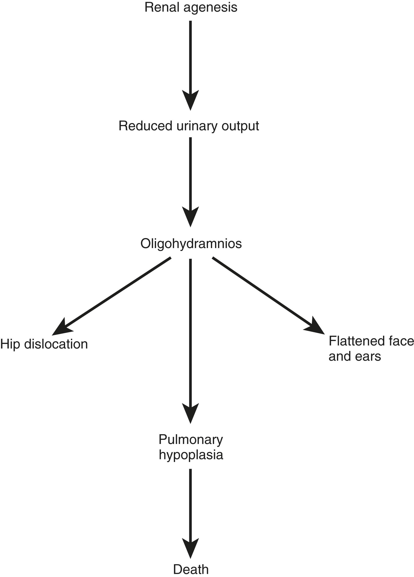 Fig. 16.16, Major steps in development of the Potter sequence.