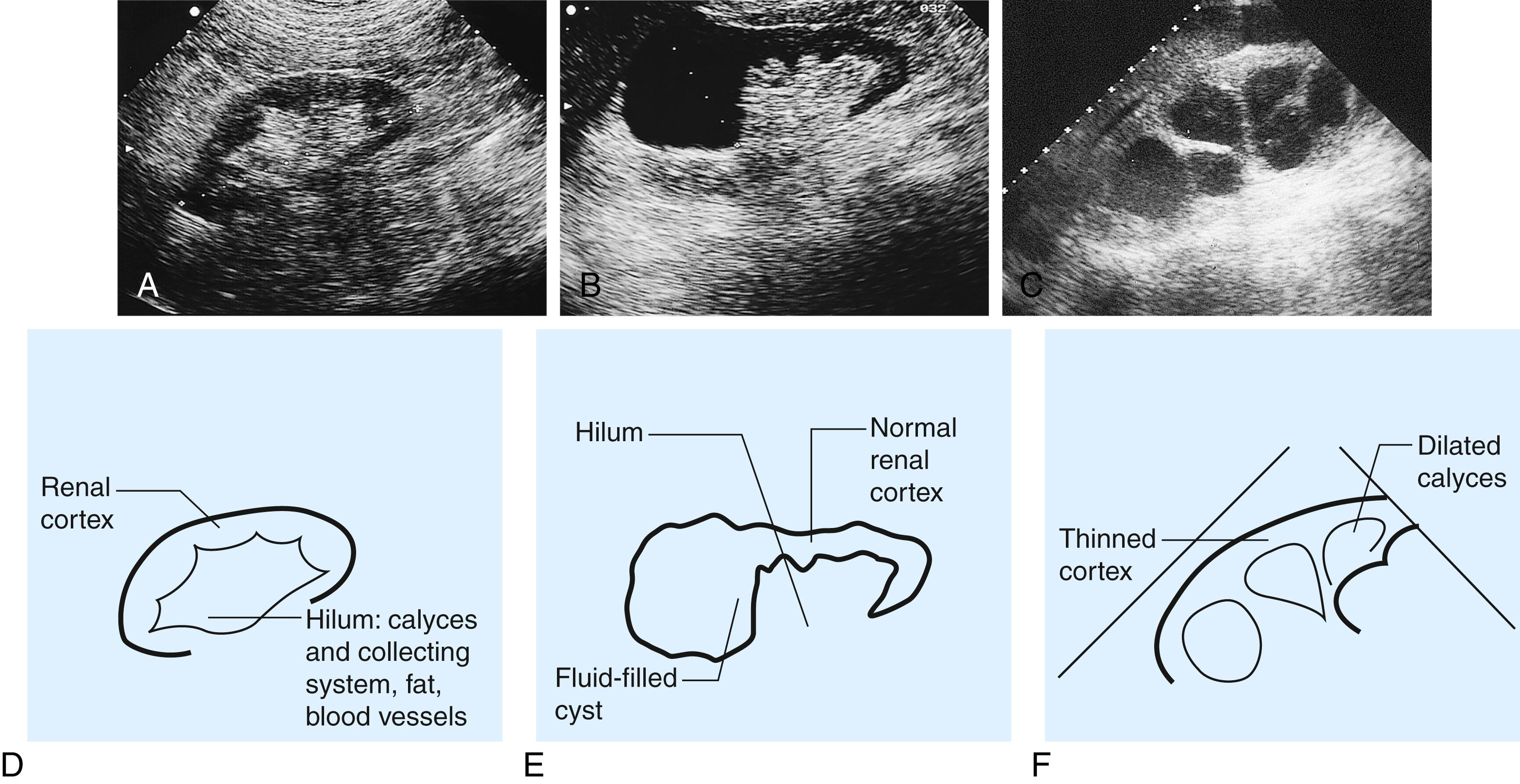 Fig. 24.2, Renal ultrasound.