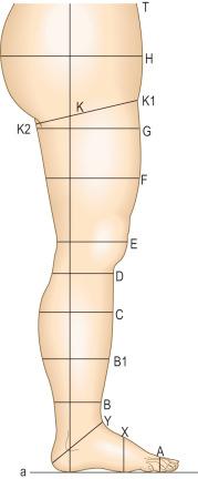 Figure 6.11, Measuring points, lengths and girths on the human leg. Note: measurements should be taken of the patient's leg in a standing position. 74