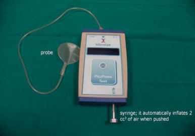 Figure 6.13, Instrument to measure interface pressure continuously. The flat probe is filled with 2 mL air and may be left deflated on the leg for several days.