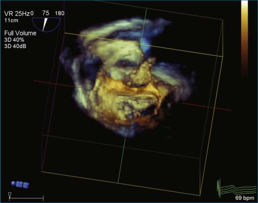 Figure 17-2, Crop box on.