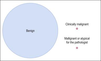 Figure 19.1, Estimated comparative frequency of benign, atypical, and malignant smooth muscle tumors of the uterus.