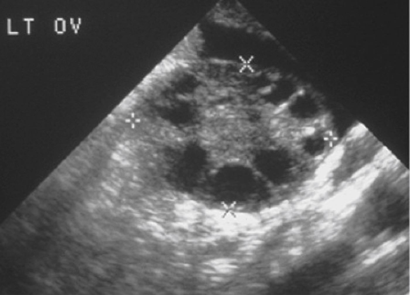 Figure 28.1, Normal ovary.