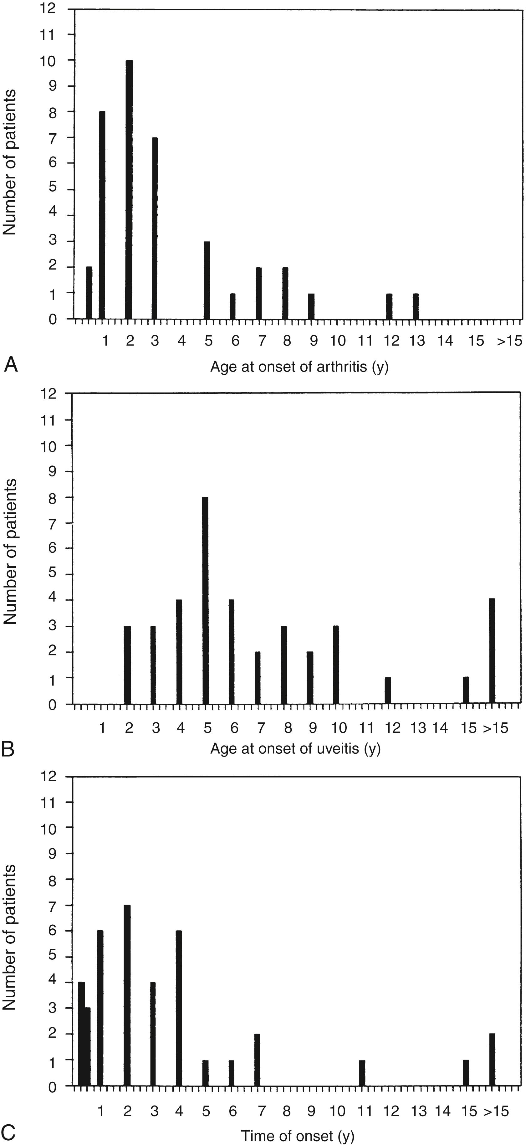 Fig. 22.2, Graphs showing the temporal relationships between arthritis and uveitis in children with juvenile idiopathic arthritis. A, The distribution of age at onset of arthritis in a series of 38 children who developed uveitis. B, The distribution of age at onset of uveitis in the same children. Note that in four patients, uveitis began after their 15th birthday: at 15 ½, 18, 31, and 39 years of age. C, Interval between onset of arthritis and diagnosis of uveitis in these patients. Note that for one patient the interval was 29 years, and for another, 34 years.