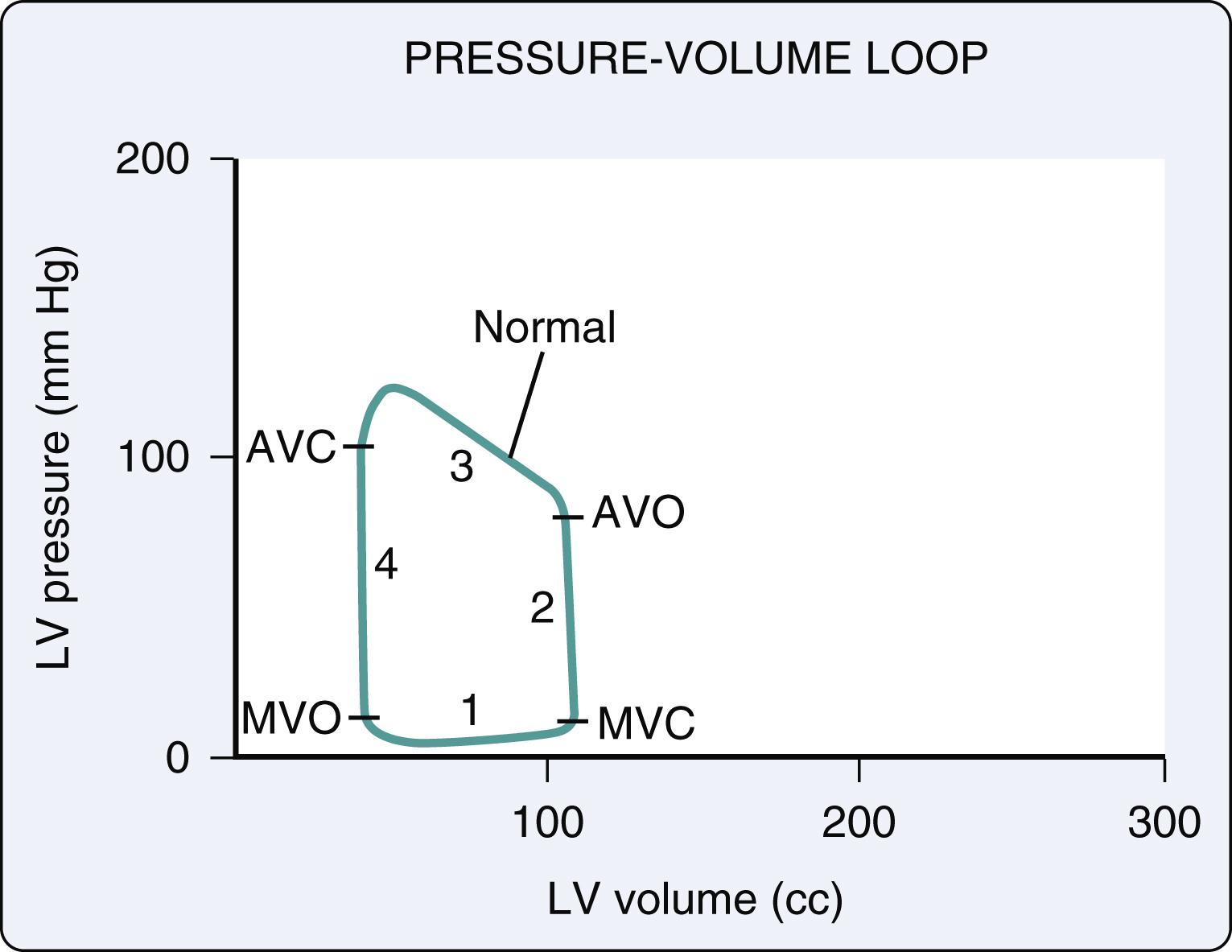 Figure 15.2, An idealized pressure-volume loop for a single cardiac cycle. AVC , Aortic valve closure; AVO , aortic valve opening; LV , left ventricular; MVC , mitral valve closure; MVO , mitral valve opening; 1–4 , phases of the cardiac cycle.