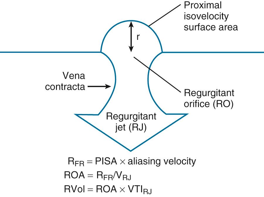 Fig. 12.10, Proximal isovelocity surface area concept.