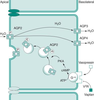 FIGURE 62.1, Schema of vasopressin-induced water reabsorption. Vasopressin binding to the V2 receptor induces the production of cyclic adenosine monophosphate (AMP) through G protein. The increase of cAMP causes protein kinase A activation of aquaporin 2 (AQP2) phosphorylation that affects AQP2 movement from the intracellular compartment to the apical membrane. AQP2 moved in the apical membrane permeates water from the lumen into the cell. Vaptan blocks the V2 receptor and decreases water permeability by stopping the sequence.