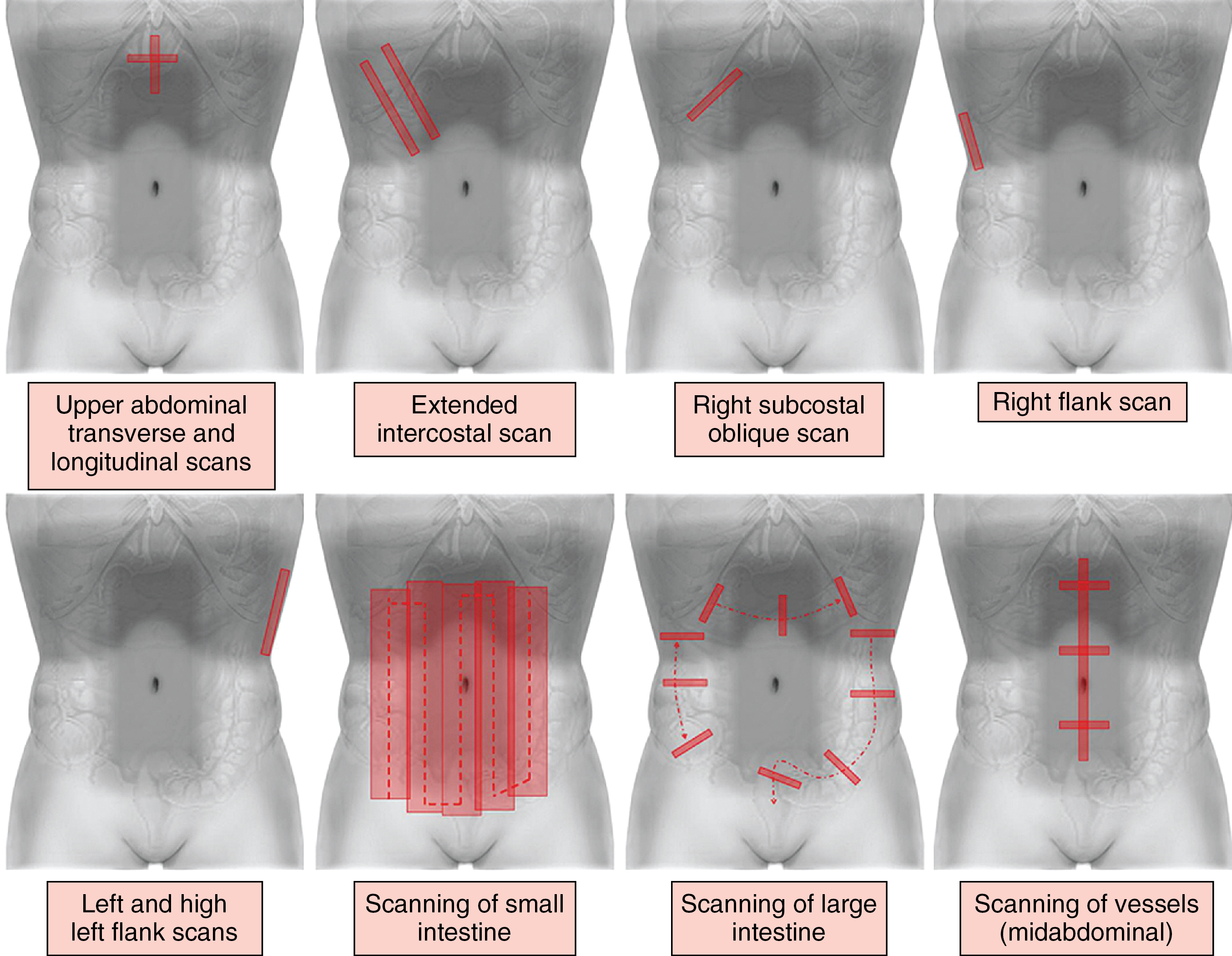 Figure 41-1, Standard and supplemental abdominal scanning planes (refer also to Figures 41 E-1 to 41 E-6 ).