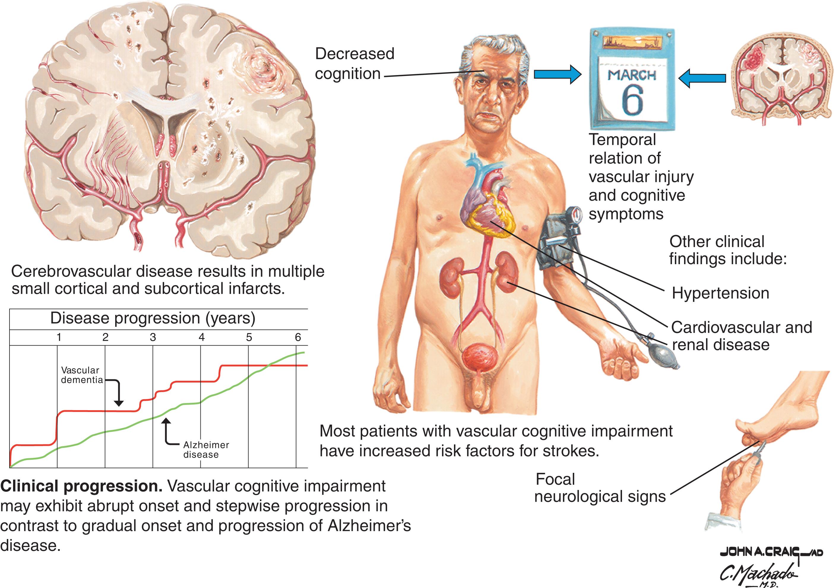 Fig. 7.1, Vascular cognitive impairment