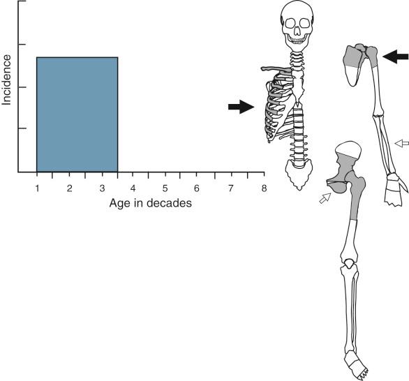 FIGURE 13-26, Massive osteolysis.