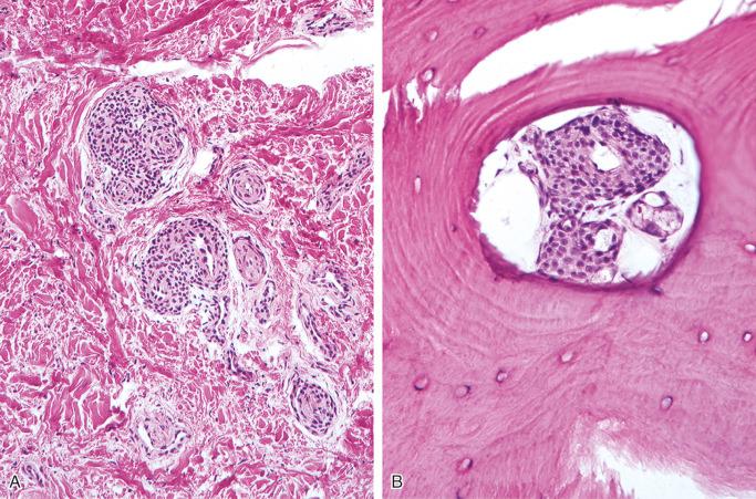 FIGURE 13-32, Glomus body: microscopic features.