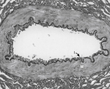 Figure 1-1, Photomicrograph of normal small muscular artery (VVG × 650). I, intima; M, media; A, adventitia. The wavy black line between the intima and media is the internal elastica lamina.