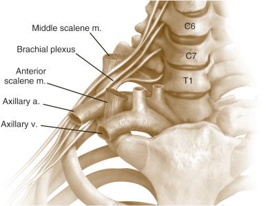 Fig. 55.3, Normal bony anatomy and neurovascular relationships of the thoracic outlet. a, Artery; m, muscle; v, vein.