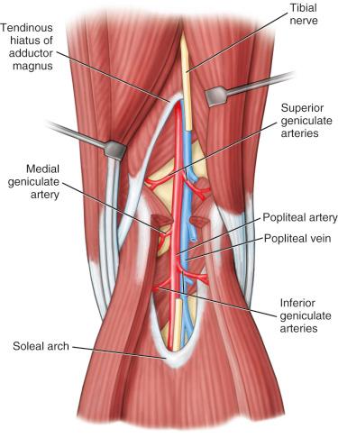 Fig. 109.1, Anatomy of the popliteal artery.