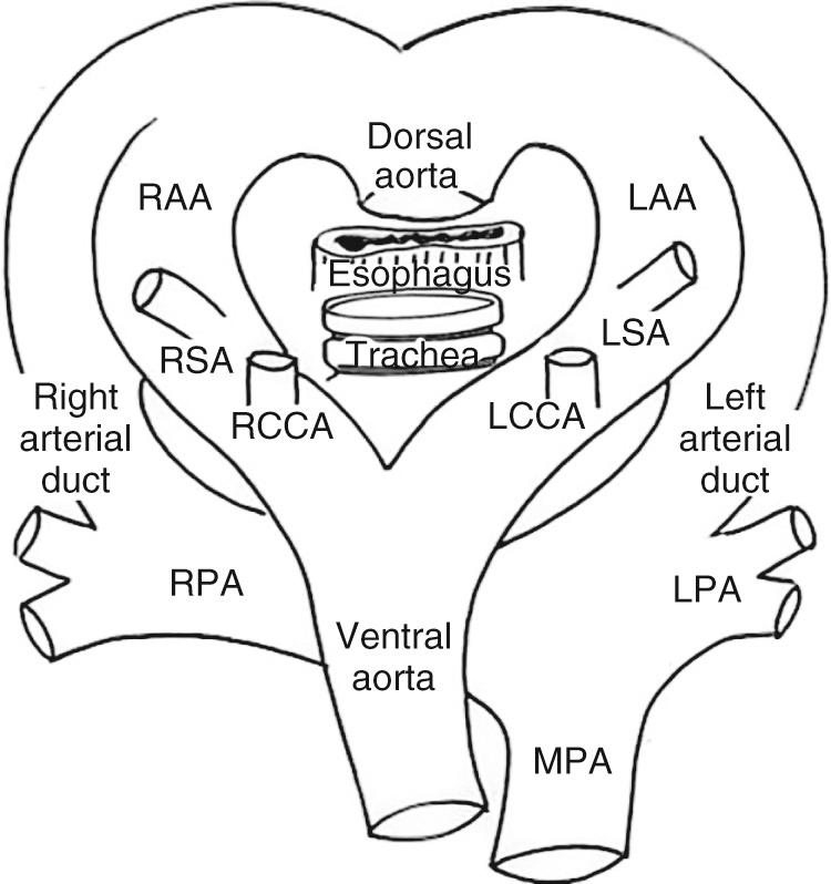 Fig. 47.1, The hypothetical model for the perfect double aortic arch proposed by Jesse E. Edwards. All malformations involving the arch can be understood on the basis of this model. LAA , Left aortic arch; LCCA , left common carotid artery; LPA , left pulmonary artery; LSA , left subclavian artery; MPA , main pulmonary artery; RAA , right aortic arch; RCCA , right common carotid artery; RPA , right pulmonary artery; RSA , right subclavian artery.