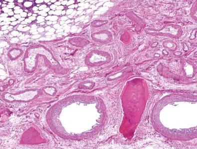 Figure 13-12, A nutrient artery and its branches are composed of an aggregate of well-formed, thick-walled vessels.