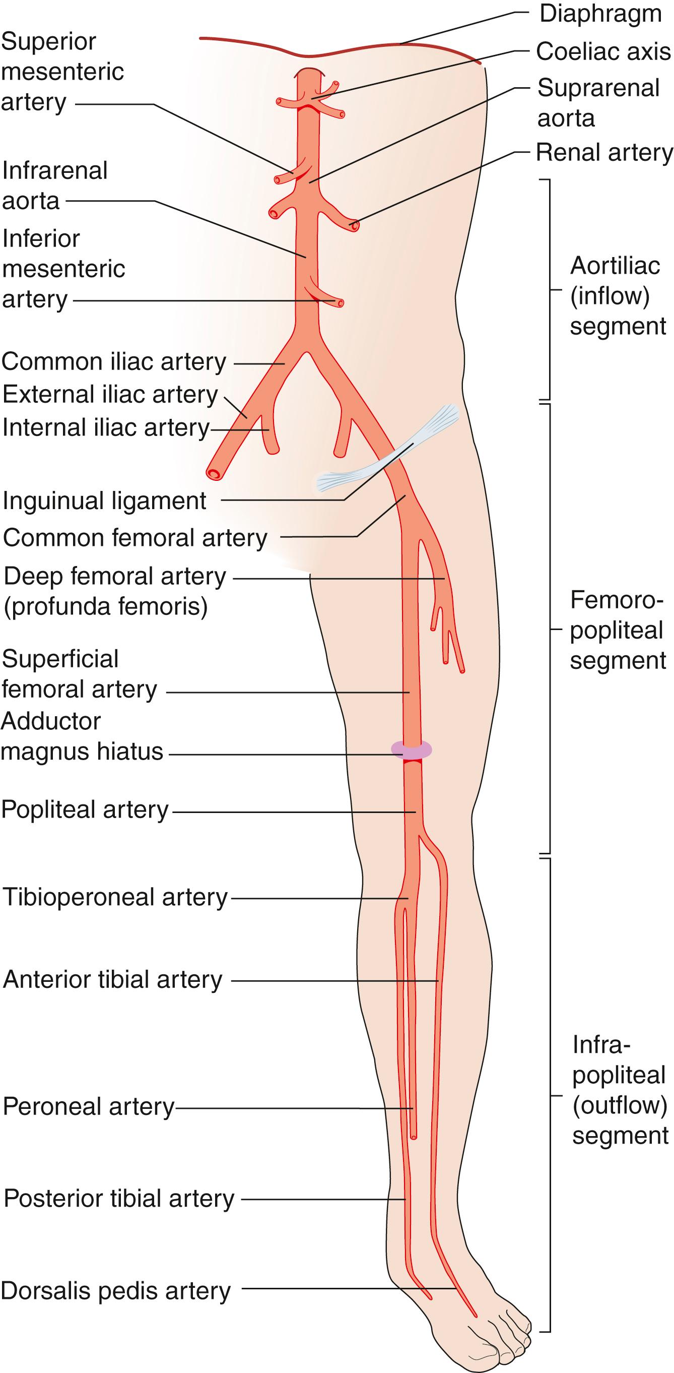 Fig. 22.3, Aortic and lower-limb arterial anatomy.