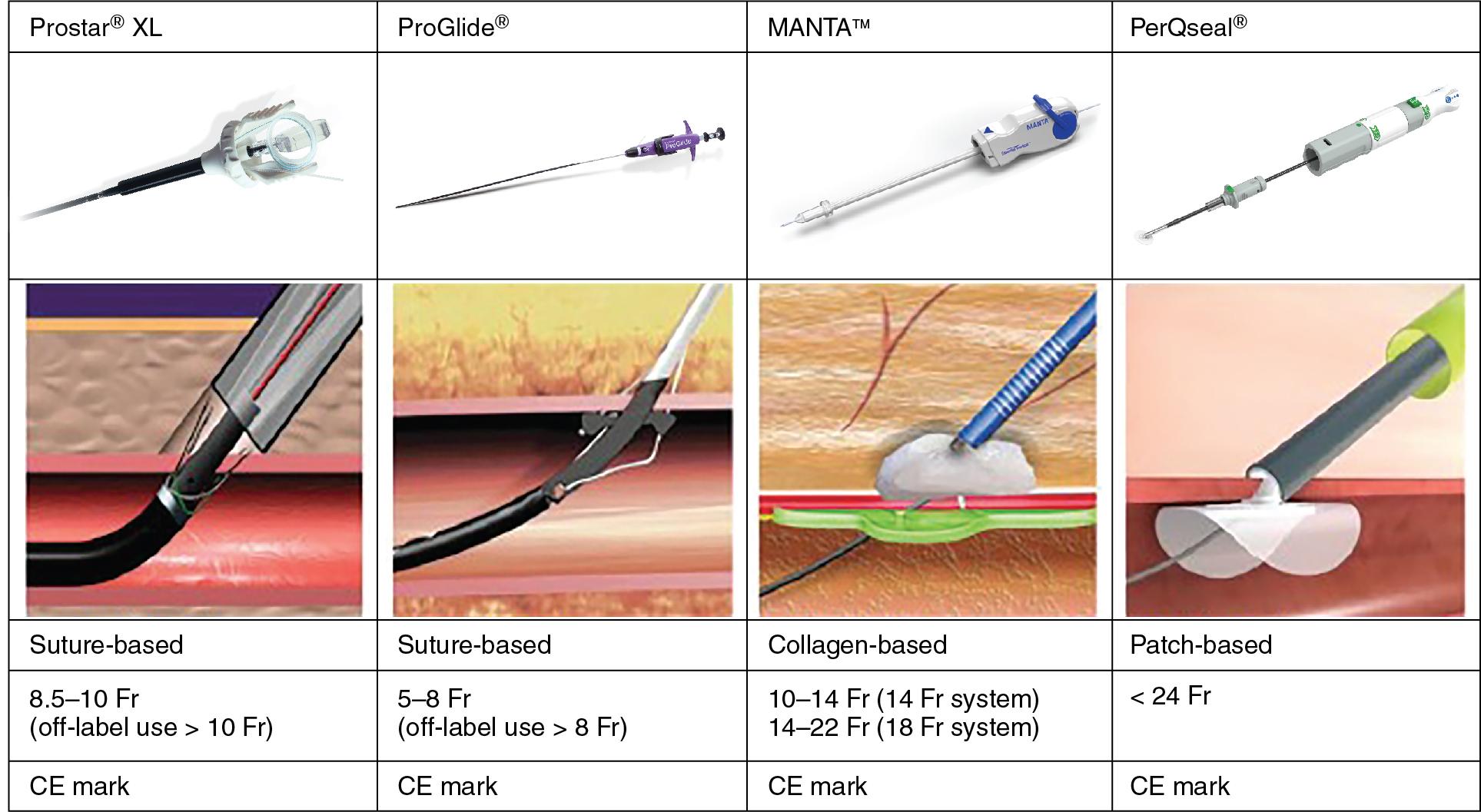 Fig. 11.2, Commercially Available Vascular Closure Devices.