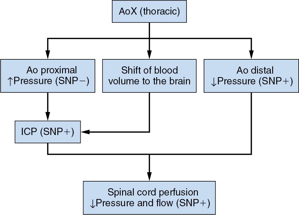 Fig. 12.6, Spinal cord blood flow and perfusion pressure during thoracic aortic occlusion, with or without sodium nitroprusside (SNP) infusion. The arrows represent the response to aortic cross clamping (AoX) per se. ↑, Increased; ↓, decreased; Ao, aorta; ICP, intracranial pressure; SNP +, the effects enhanced by SNP infusion; SNP −, the effects counteracted by SNP infusion.