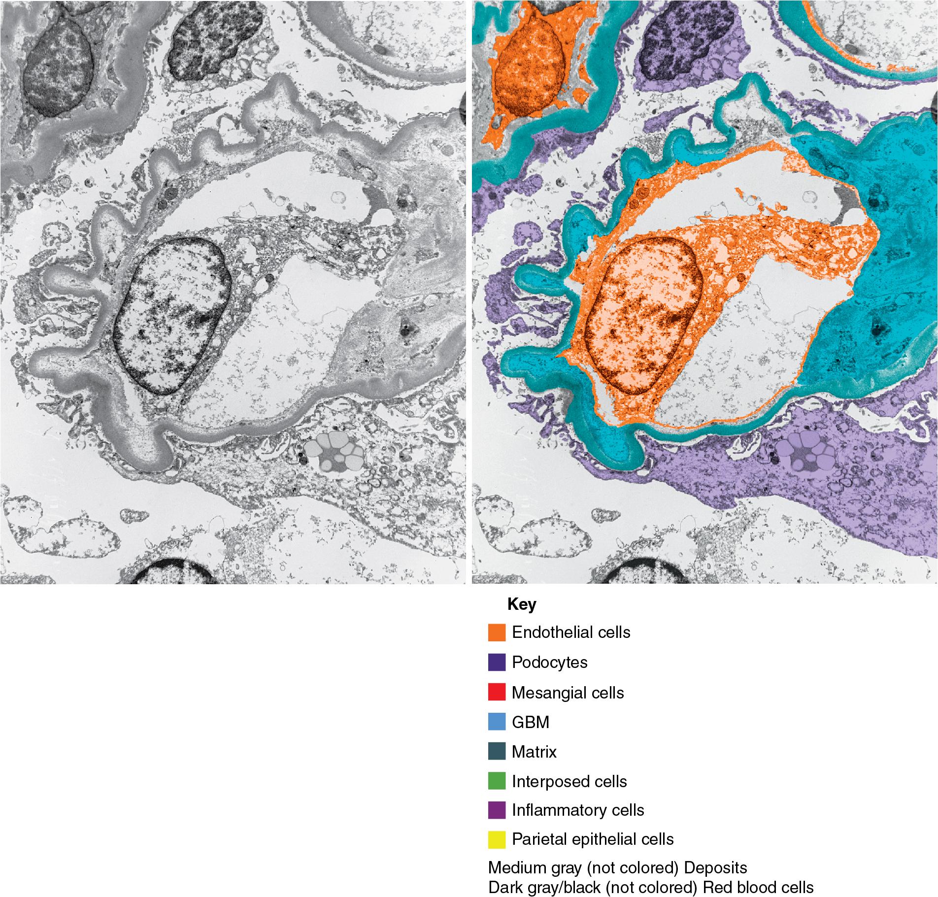 FIG. 4.54, Scleroderma.