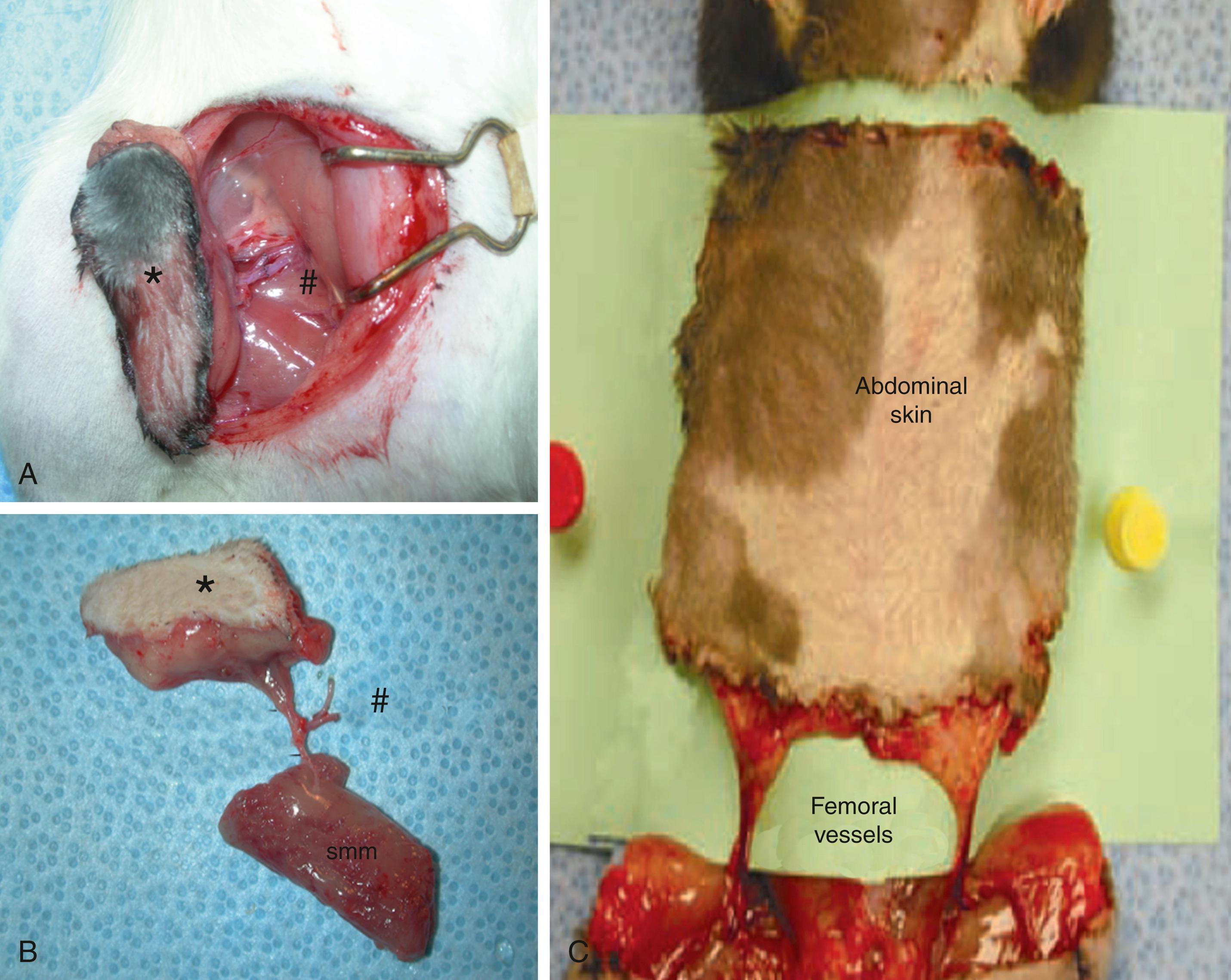 Fig. 11.1, Skin-containing VCA models. (A) Groin flap (∗) raised on vascular pedicle (#) of the femoral artery and vein. (B) Semimembranosus muscle and epigastric skin flap model. ∗ Epigastric flap; # vascular pedicle; smm , semimembranosus muscle. (C) Total abdominal wall transplant model harvested on the bilateral vascular pedicle of the femoral artery and vein.