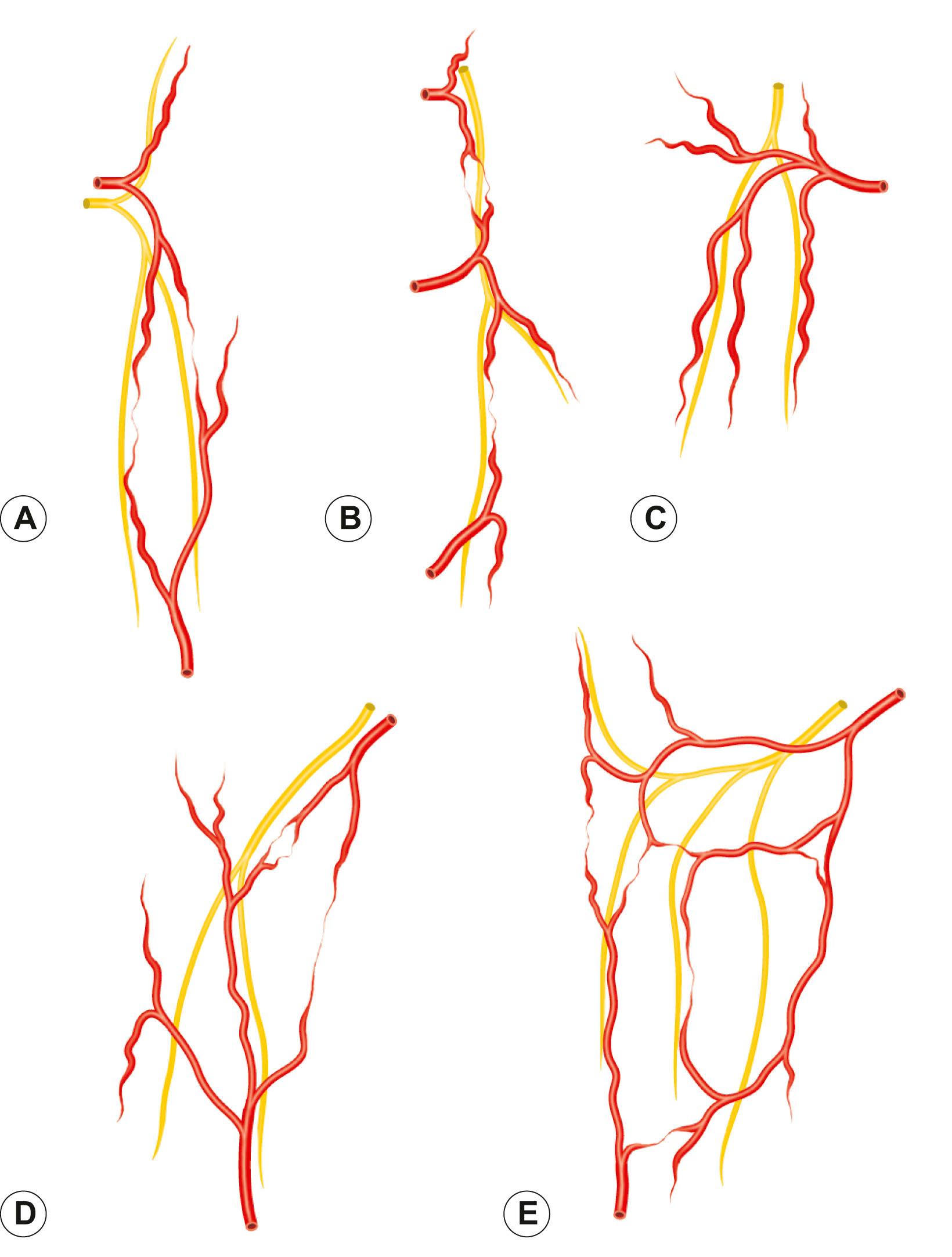 Figure 23.15, The neurovascular patterns found in the integument. (A) A long artery connected to its neighbor by a true anastomosis courses with the nerve. (B) A chain-linked system of arteries hitchhikes with the nerve. (C) The nerve and artery pierce the deep fascia at separate sites. Branches of the vessel peel off to accompany the nerve as it crosses the main arterial trunk. (D) The nerve at first courses parallel to an artery and then approaches the neighboring artery from its periphery to descend along its branches toward the main trunk. (E) The nerve crosses the primary and secondary arcades of the artery before coursing parallel to the vascular network.