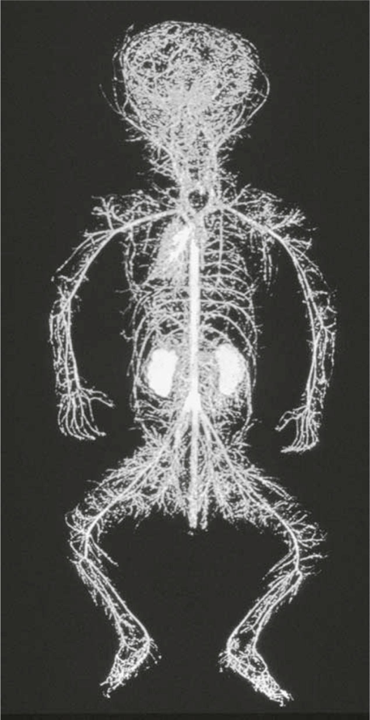 Figure 23.2, Tompsett's arterial skeleton of the body. This corrosion cast of the newborn body shows the arterial architecture of the body.