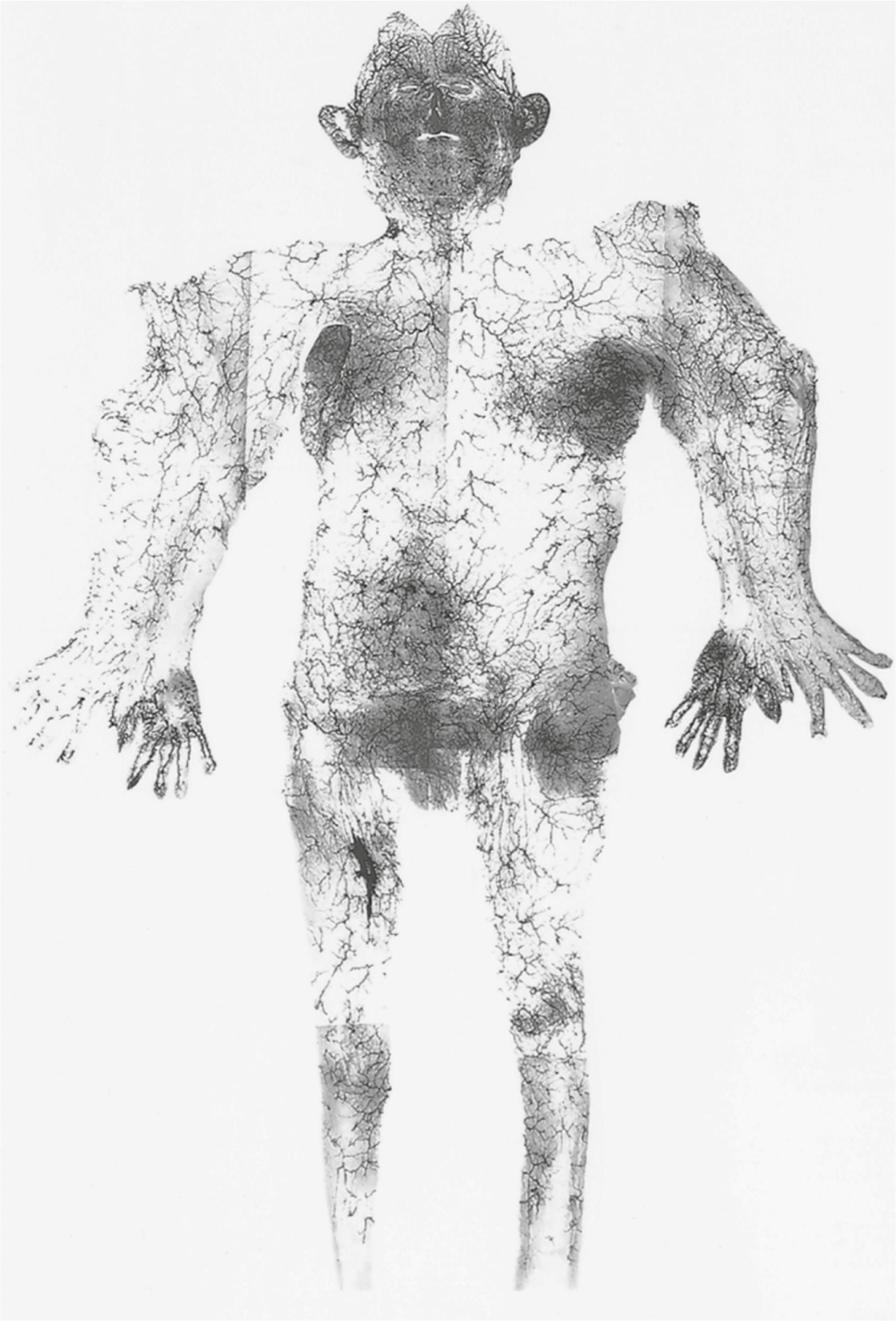 Figure 23.7, Montage of the cutaneous arteries of the body. The skin has been incised along the ulnar border in the upper extremities, and the integument has been removed with the deep fascia on the left side and without it on the right. Note: (1) the direction, size, and density of the perforators, which are large on the torso and head and become progressively smaller and more numerous toward the periphery of the limbs; and (2) the reduced-caliber (choke) anastomotic arteries, which link the perforators into a continuous network.