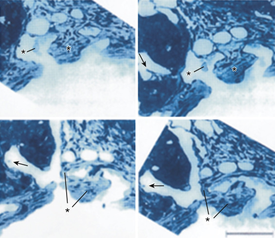 FIG 70-18, Cross-sectional images confirm the first blood vessels that form are venous (venous loops seen at arrows ), with very few arteries.