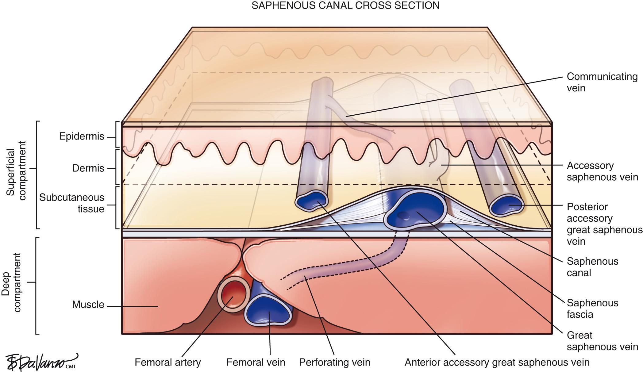 Fig. 1.3