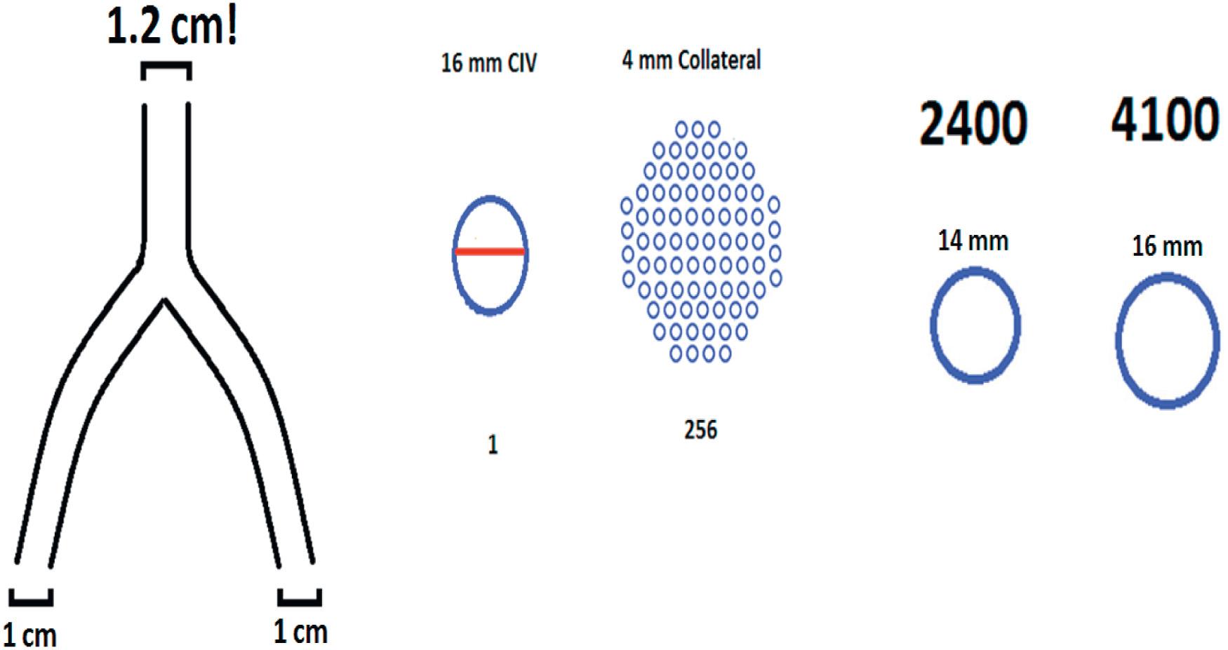 Fig. 2.4, Surprising effects of the “geometric factor” ( πr 4 ) in the Poiseuille equation. CIV , Common iliac vein.