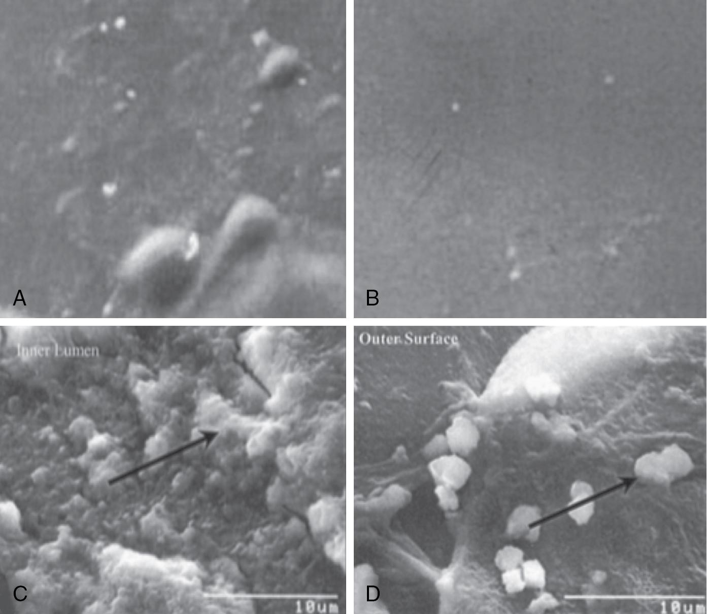 Fig. 5.1, Electron micrographs of the inner (A) and outer (B) surfaces of a sterile endotracheal tube before use and the inner (C) and outer (D) surfaces after 8 days of intubation. The 8-day micrographs demonstrate individual cocci (arrows) within a thick biofilm.