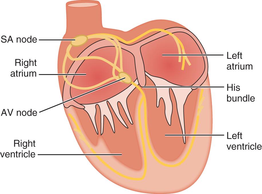 Fig. 72.1, Conduction system of the heart. AV, Atrioventricular; SA, sinoatrial.