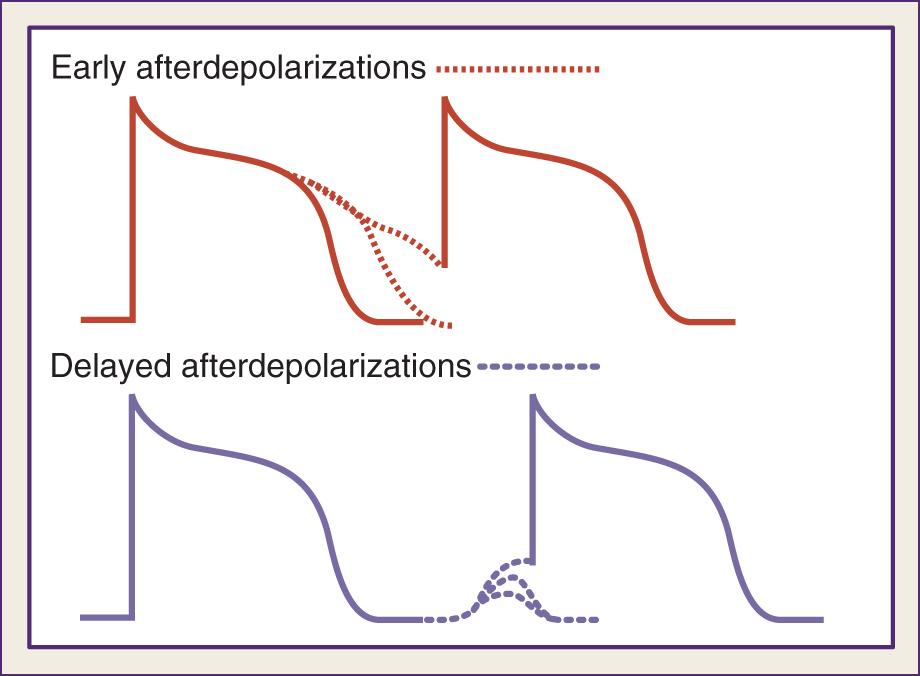 Fig. 72.3, Afterdepolarizations (dotted lines) . Early afterdepolarizations are retardations in repolarization with prolongation in action potential duration (upper figure) . Delayed afterdepolarizations represent spontaneous depolarizations that occur after repolarization is over (lower figure) . Afterdepolarizations that reach a threshold trigger an action potential.