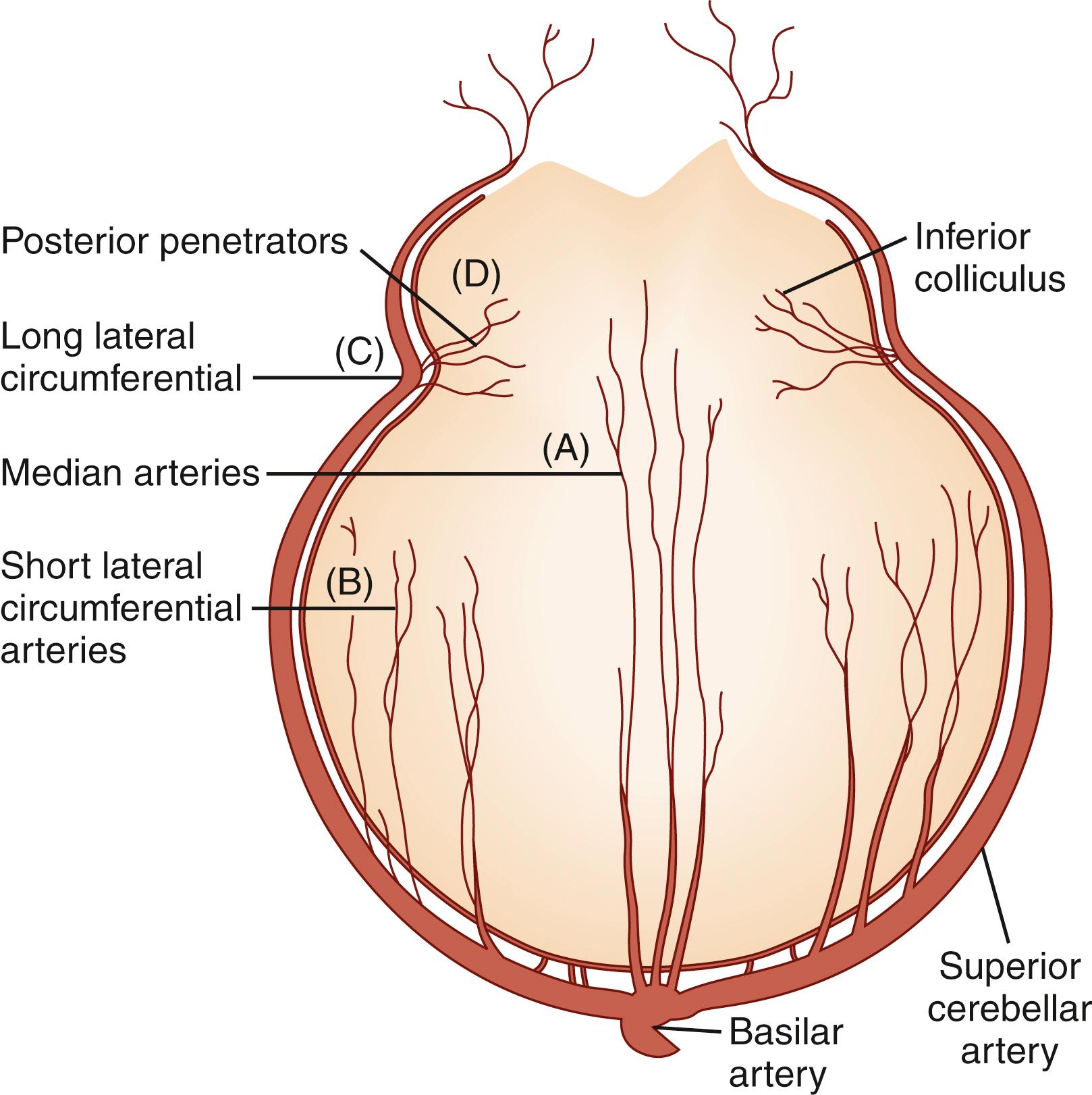 Fig. 26.5, Rostral pons with the usual arterial distribution. (A) Median penetrating arteries. (B) Short lateral circumferential arteries. (C) Long lateral circumferential artery. (D) Posterior penetrating arteries.