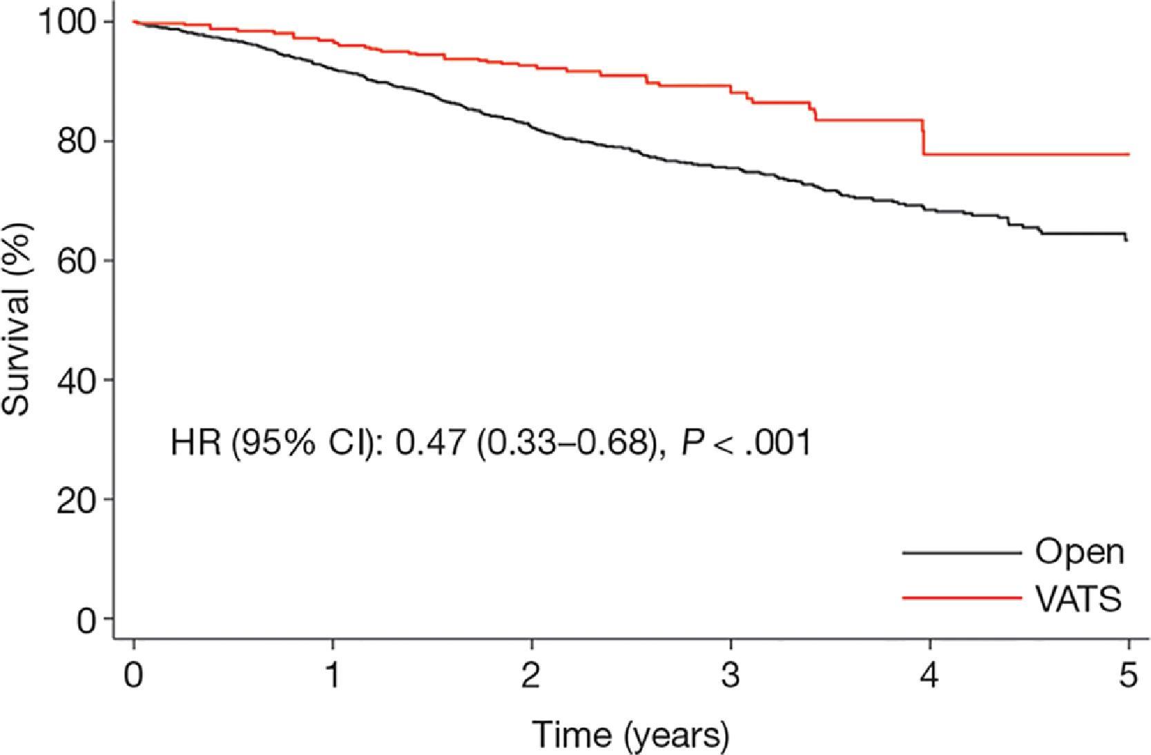 • Fig. 31.1, Kaplan-Meier curve of the survival after open thoracotomy or VATS. CI , Confidence interval; HR , hazard ratio; VATS , video-assisted thoracoscopic surgery.