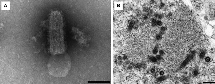Figure 8-6, Ultrastructure of rabies virus. Bullet-shaped virions are seen by negative stain transmission electron microscopic examination of fresh cerebellum extract (scale bar 100 nm) (A) . Thin section transmission electron microscopy shows aggregates of electron dense material accompanied viral particles (scale 500 nm) (B) .