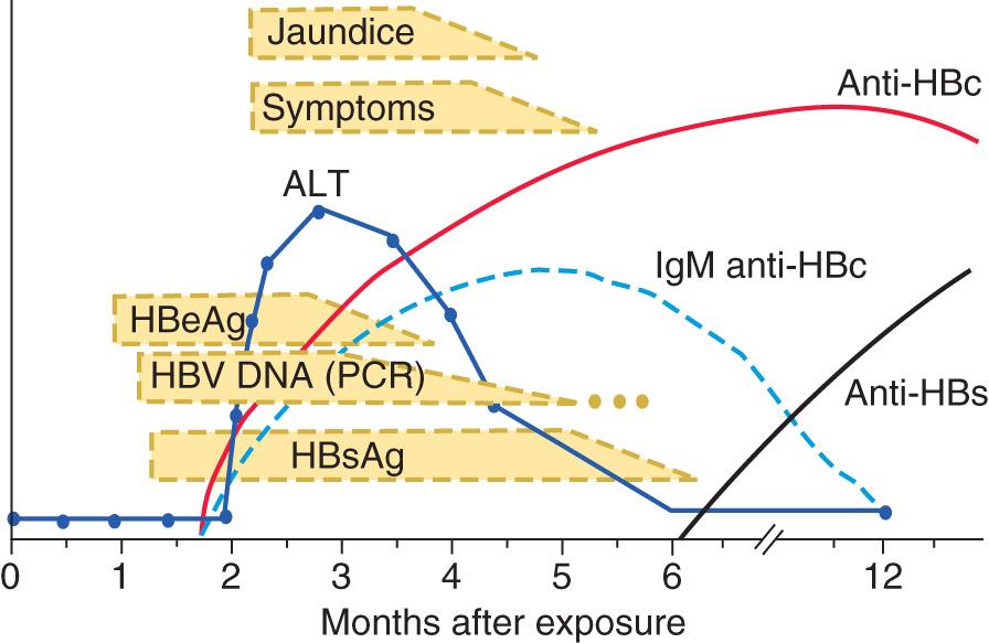 Fig. 385.2, The serologic course of acute hepatitis B.