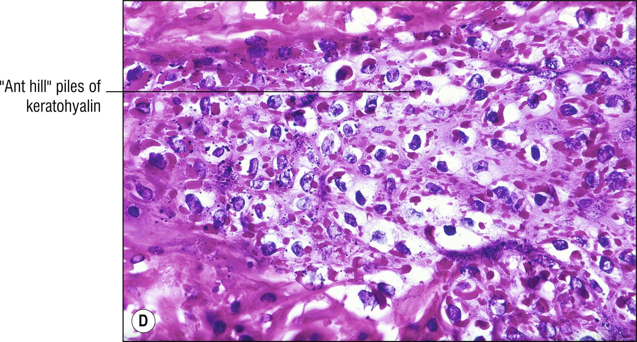 Fig. 14.1, D Myrmecia wart.