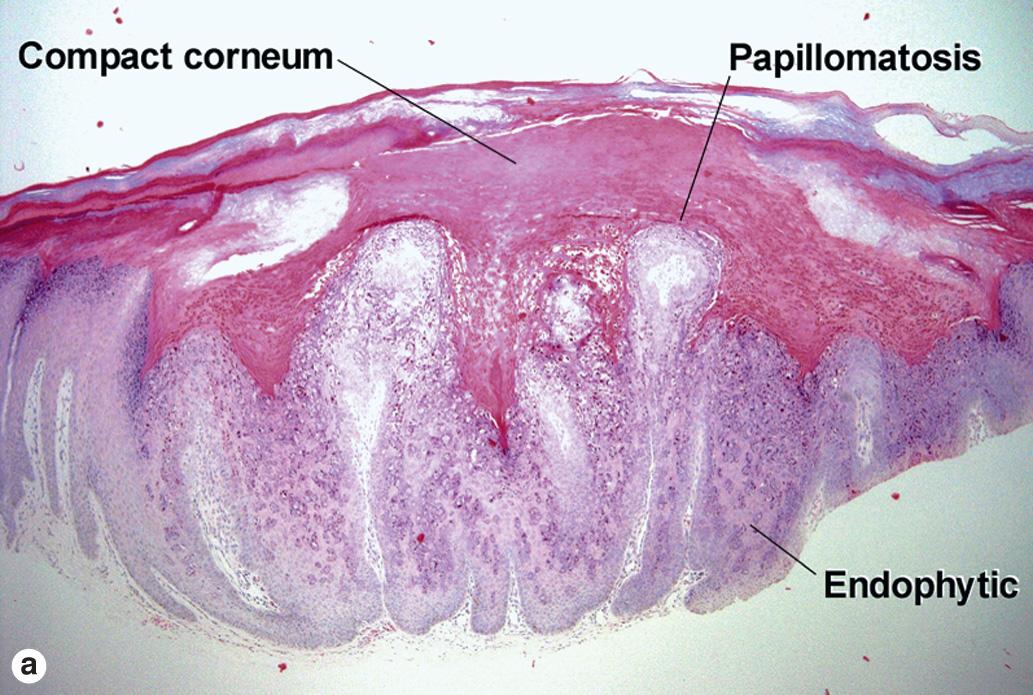 Fig. 19.2, Myrmecia